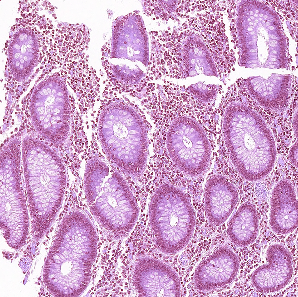 Original Pathology Gland