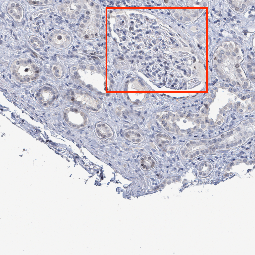 Localized Capillaries