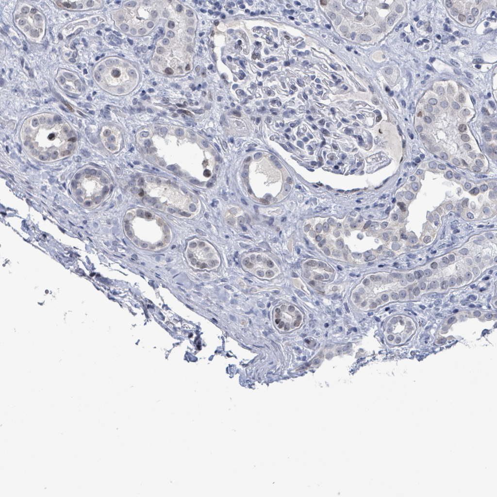 Original Capillaries