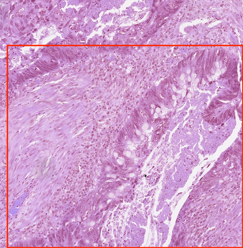 Localized Gland