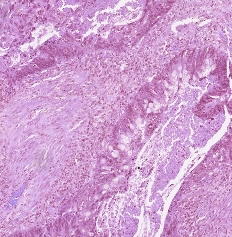 Original Gland