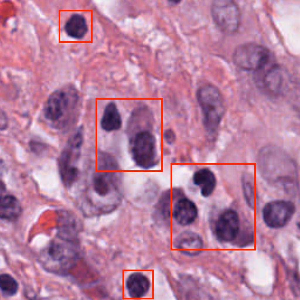 Localized Nuclei